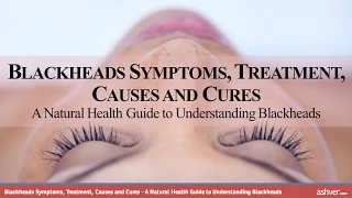 blackheads symptoms treatment causes and cures a natural health guide to understanding blackhead