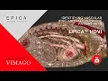 Download Lagu Identifying Vascular Ring Anomaly in Canine Patient with Epica™ HDVI