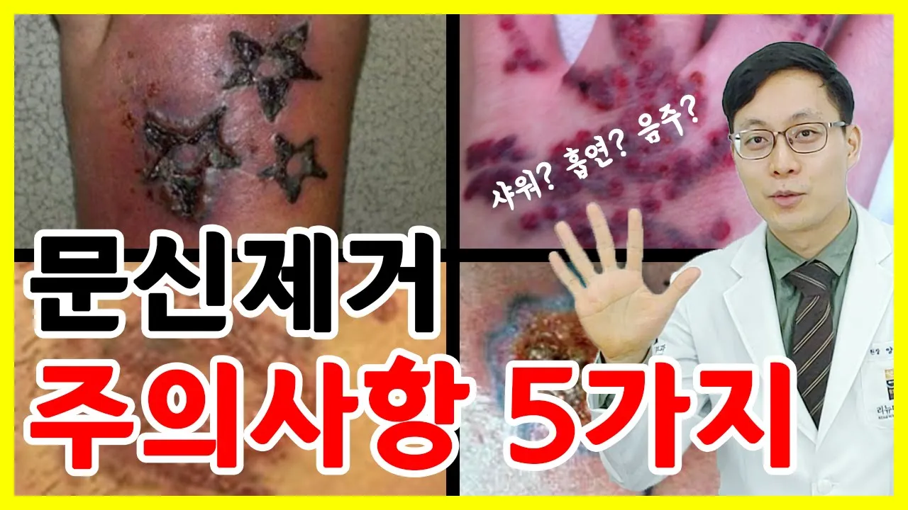 문신제거 관리하는 것도 중요합니다! 문신제거 주의사항 5가지