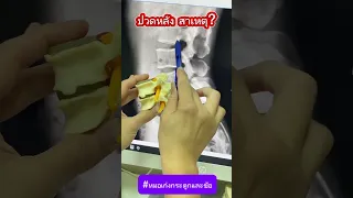  อาการปวดหลังในคนอายุ 20-40 ปี มีสาเหตุจากอะไรบ้าง 