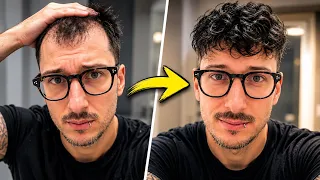 Come ho risolto il problema dei capelli | LOOKMAXING #1