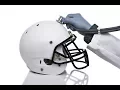 Aaron Hernandez s CTE 5 Facts About This Brain Disease