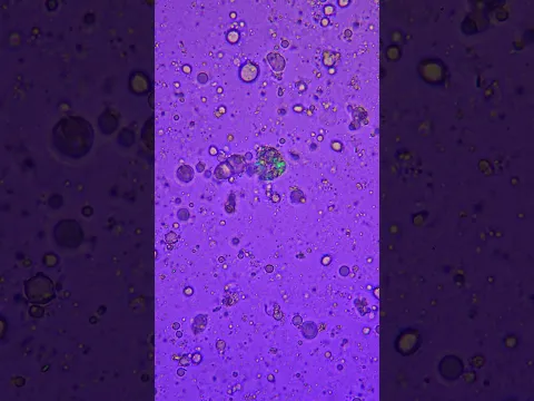 I Put Colostrum Under a Microscope… WHAT?!