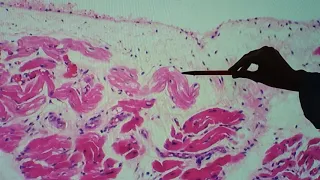 Histologia do coração