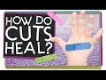 How Do Cuts Heal