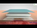 Download Lagu Visual Representation of Mextra Superabsorbent - Solmed Pty Limited