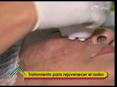 Tratamiento para rejuvenecer el rostro