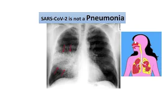 محمد شحادة آغا متحدثا عن فايروس كورونا الجزءالثالث Dr Mohmmad Shadeh Agaa  محمد شحادة آغا متحدثا عن فايروس كورونا الجزءالثالث Dr Mohmmad Shadeh Agaa