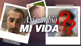 ASI MEJORE MI AUTOESTIMA | MI INJERTO CAPILAR