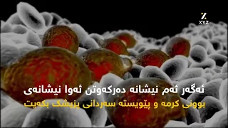 چۆن دەزانیت لەشت کرمی هەیە 