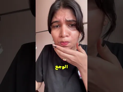 حطت ملح على الجرح وندمت 😲! #shorts