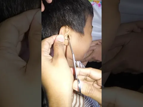 Removing STUCK Cotton From Brave Boy's Ear