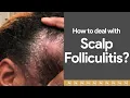 Dealing with Scalp Folliculitis Watch immediately
