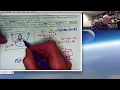 Actuarial Exam Prep Conditional Probability with Three Events in a Venn Diagram Generalization