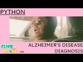 Python Image Processing - Convolutional Network for Alzheimer s Disease Diagnosis