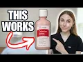 Calamine Lotion Hacks Nobody Told You About