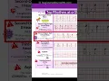 ECG EKG Rhythms to Know Sinus Rhythms Sinus Tachycardia Heart blocks etc