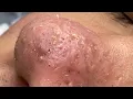 Satisfying and Relaxation with SURI NGUYEN Beauty Spa