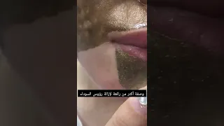 ماسك الجيلاتين لإزالة الرؤوس السوداء لبشرة كالأطفال  ماسك الجيلاتين لإزالة الرؤوس السوداء لبشرة كالأطفال