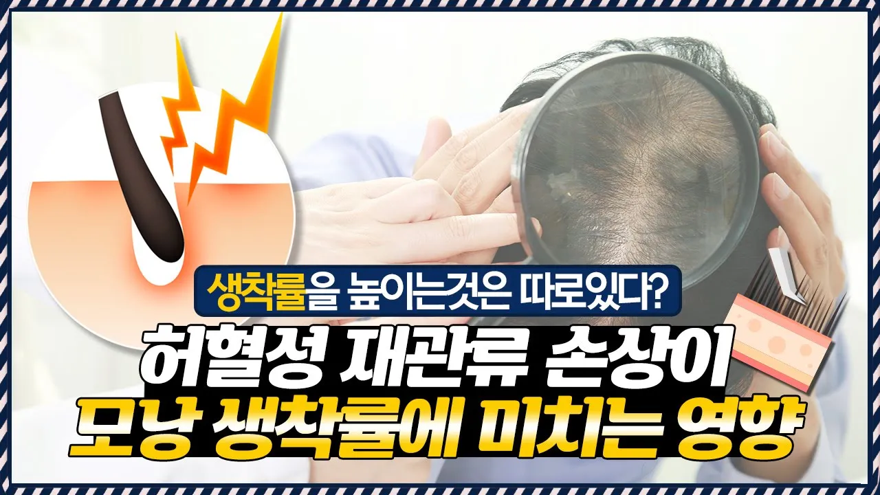 의느님답변📂#허혈성재관류손상이 #모낭생착률 에 미치는 엄청난 영향..ㄷㄷㅣ다나성형외과(DANA)ㅣ모발이식ㅣ헤어라인교정ㅣ두피문신ㅣ탈모치료