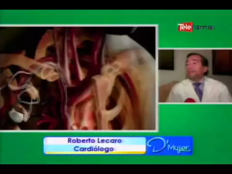 Pericarditis: causas y síntomas