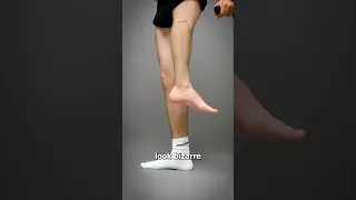 The Surgery That Turns Legs Around 🔄 Surgeon Reacts