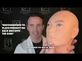 Neurotoxins: Lower Aspect of the Face