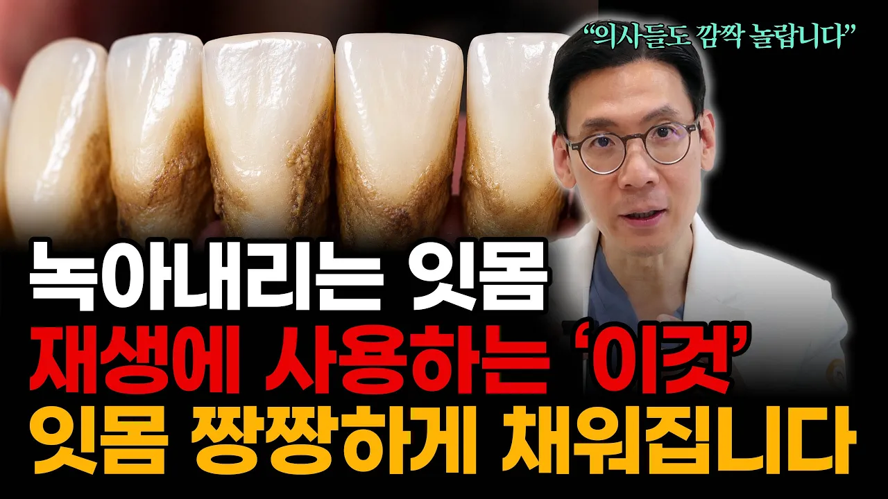 치아 빼기 전에 꼭 보세요… '잇몸뼈 재생' 가능할 수도 있습니다 (엠도게인 총정리) #잇몸치료