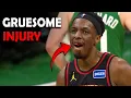 Onyeka Okongwu Injury Shocking Blow From Jaylen Brown Leaves Hawks Star Hurt