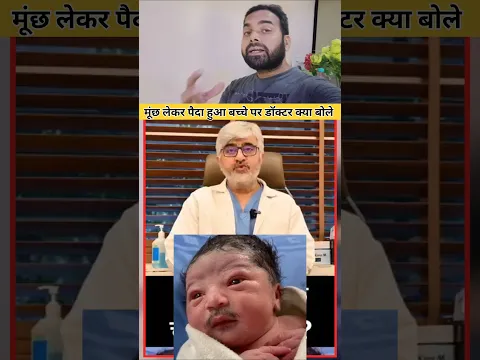 मूंछ वाले बच्चे पर डॉक्टर क्या बोले #ilovemohammadﷺ #shortsfeed #rjavedislamicgreen #shortvideo