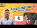 KIDNEY STONE Treatment for 4mm 5mm 6 mm Treatment ESWL RIRS - Dr Girish Nelivigi