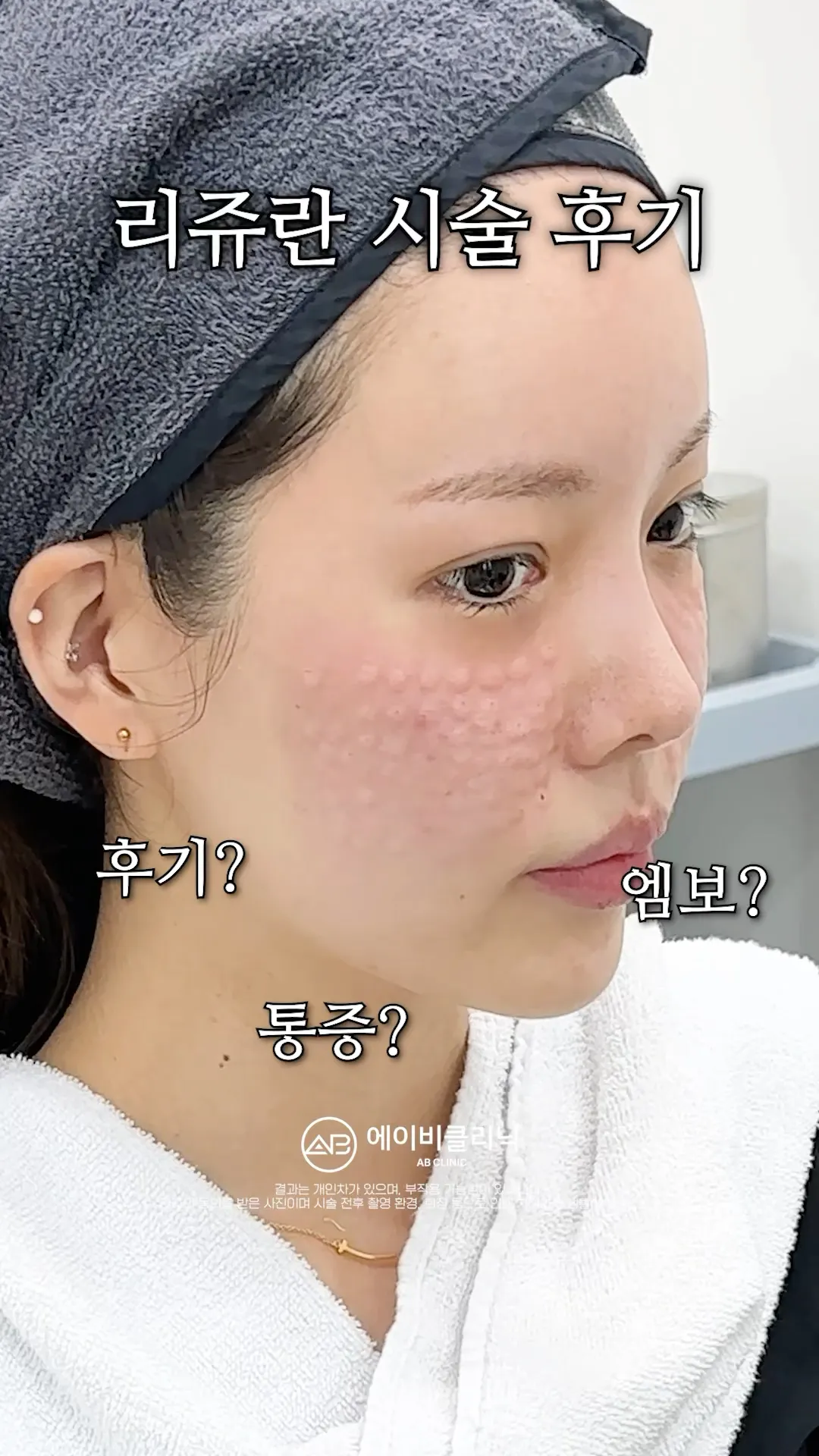 리쥬란으로 촉촉속광피부 만들기 💯