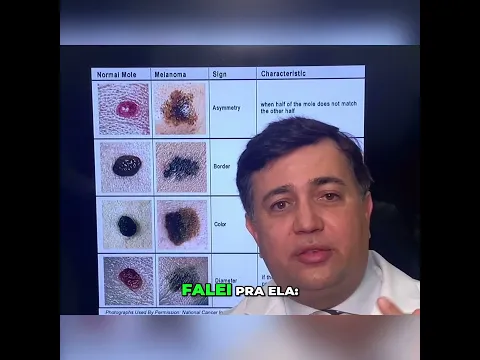 Pinta de nascença pode esconder um perigo #shorts