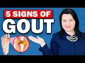 Download Lagu Gout: Everything You Need to Know