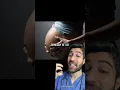 POV You Just Learned What Happens if You Take Accutane While Pregnant