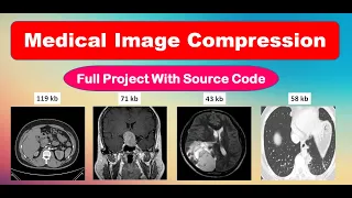 Medical Image Compression Using Wavelet Transform Medical Image Compression Using Matlab Project