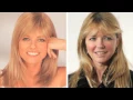 Cheryl Tiegs Before and After Plastic Surgery Photos