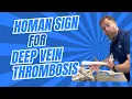 Homan s Test for Deep Vein Thrombosis