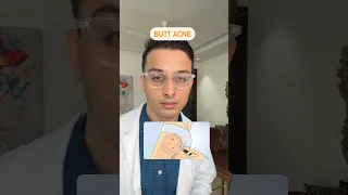 How do you deal with butt acne Dr Ankur Sarin