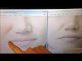 Juvederm or Restylane for Lip Enhancement Which is better Brittany White NP Skin by Lovely