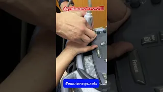  นิ้วล็อคเกิดจากอะไร และมีอาการอย่างไรบ้าง 