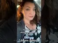 Getting a gastric sleeve was the best decision I made