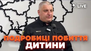 Побиття дитини указкою на Львівщині — в ОВА та поліції дали коментар - 285x160