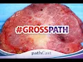 An Introduction to Gross Specimen Examination Basic Principles