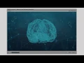 DCMA 2 Memory and Dementia Overview Course