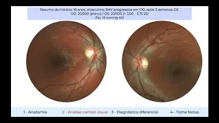 Campo visual aula 5