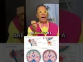 Lagu Essential tremor caused by internal jugular vein block in the neck- Check out the full video
