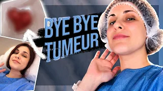 Comment je me suis ENFIN débarrassée de ma tumeur