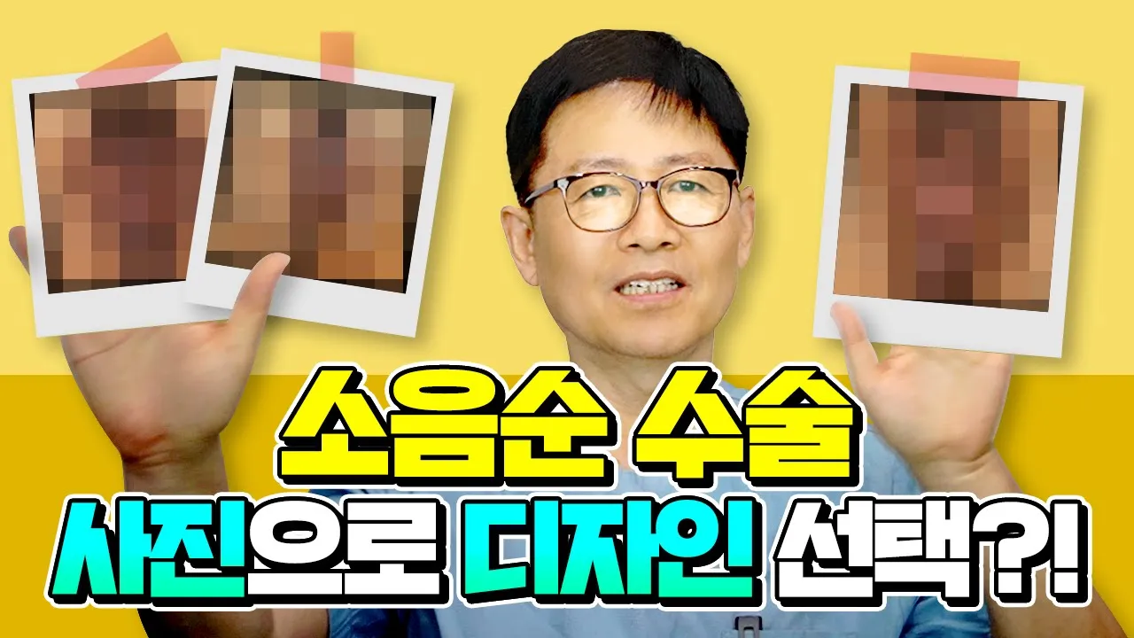 소음순수술 필요한 상태와 성형 후 모양 선택방법은?
