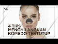 Download Lagu 4 Tips Menghilangkan Komedo Tertutup